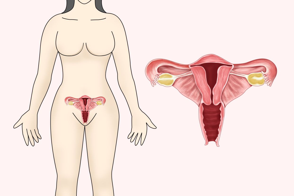 双子宫,左侧宫腔积液,右侧早孕