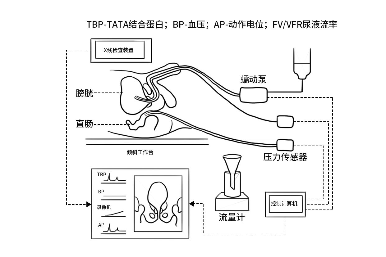 膀胱压的测量方法图解图片