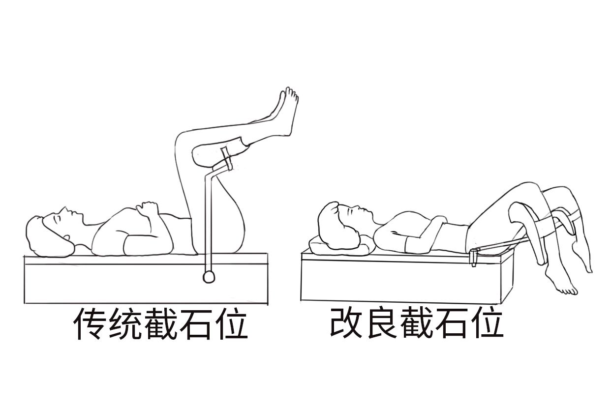 腹腔镜直肠癌手术体位图片