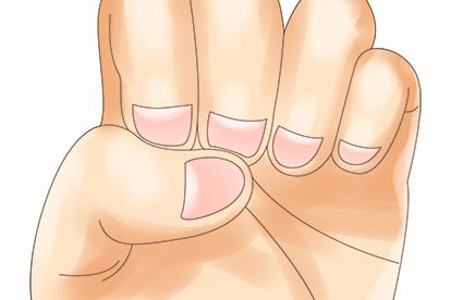 指甲长竖纹|指甲暗示着身体的健康状况
