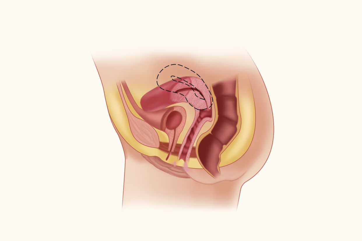 子宫内膜薄怎么调理吃什么食物可以增厚?