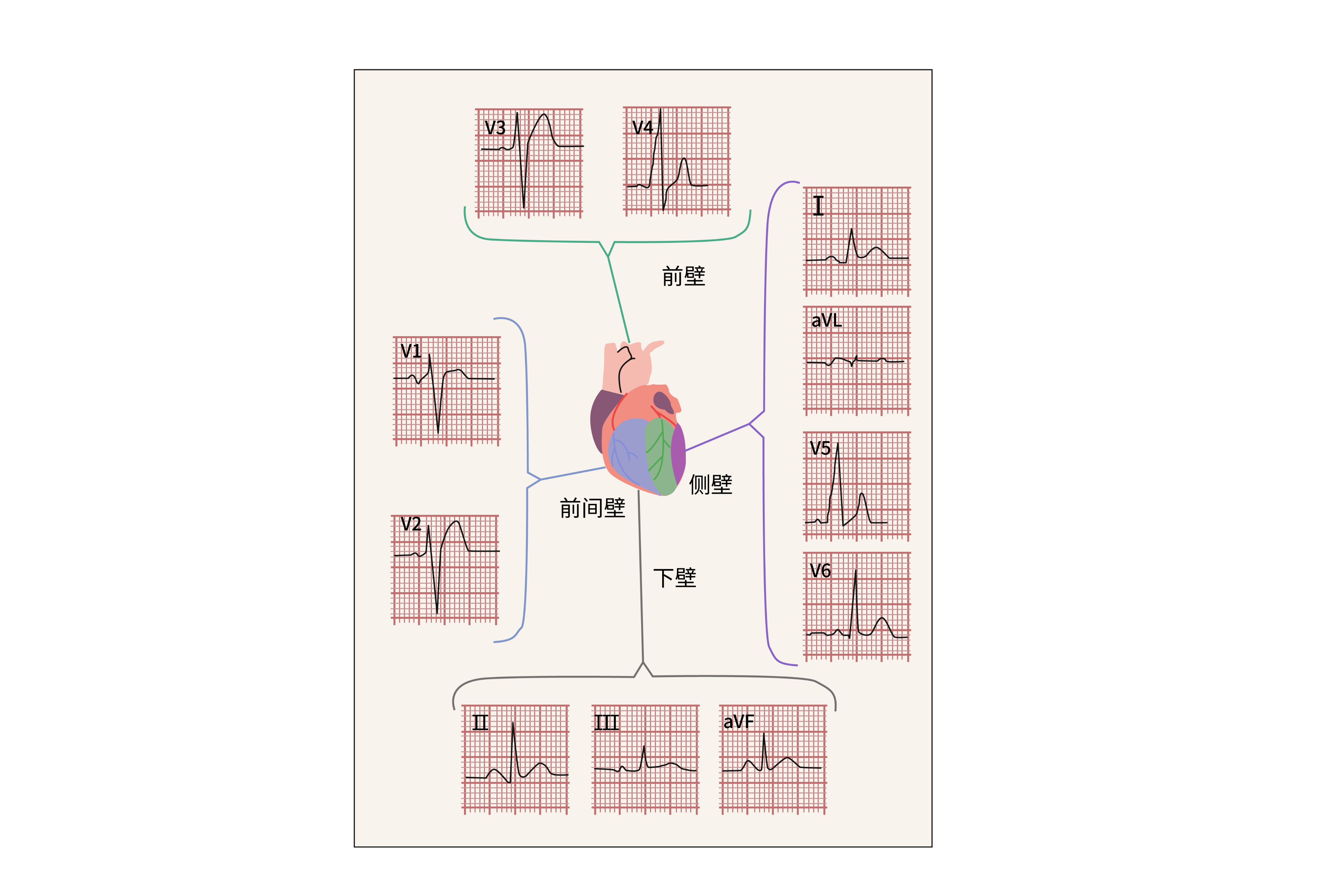 心电图图解