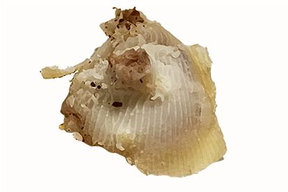 手上长刺瘊子,教你一招处理!