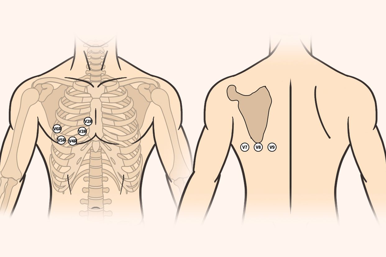 胸前区及后背导联位置图