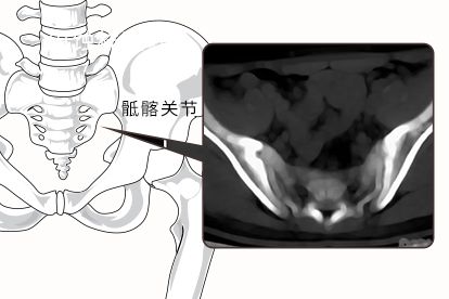 虫蚀样骨质破坏图片