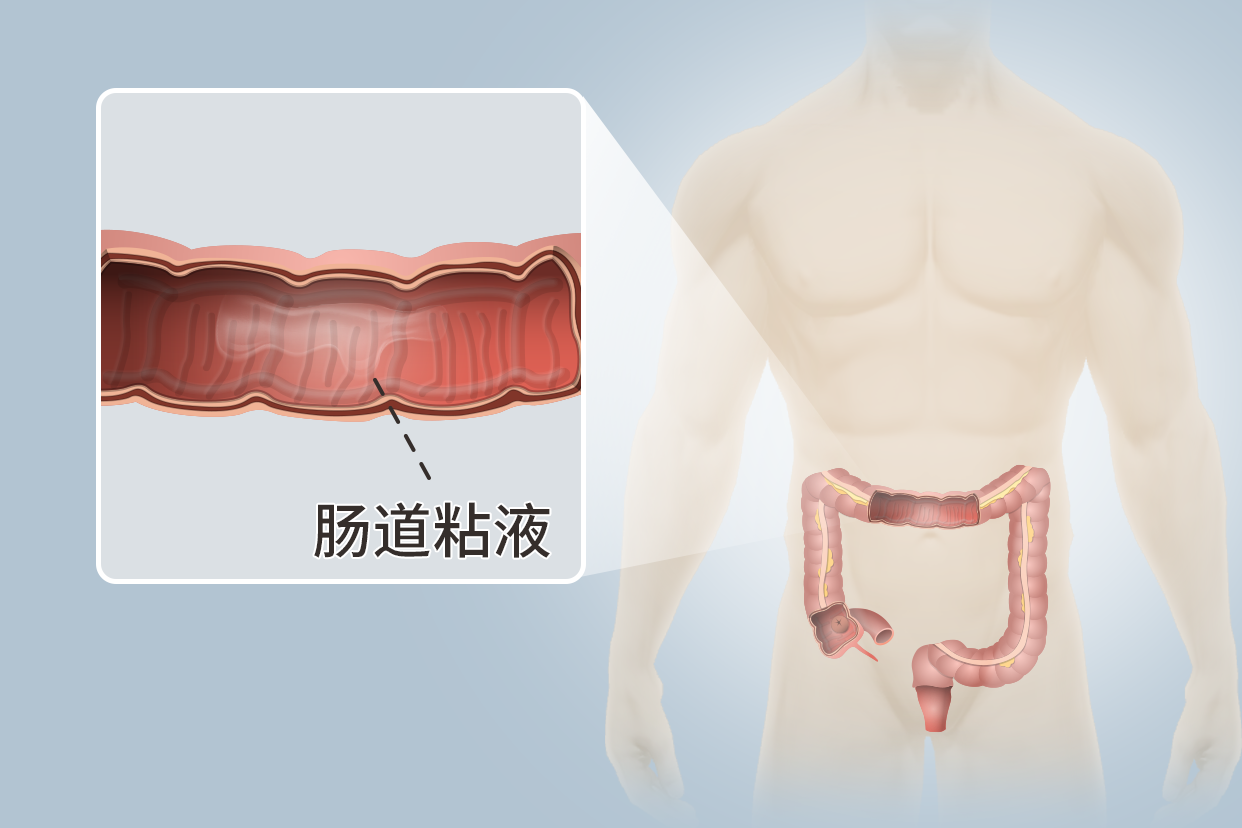 肠道菌群失调，益生菌、益生元、合生元，要怎么用？