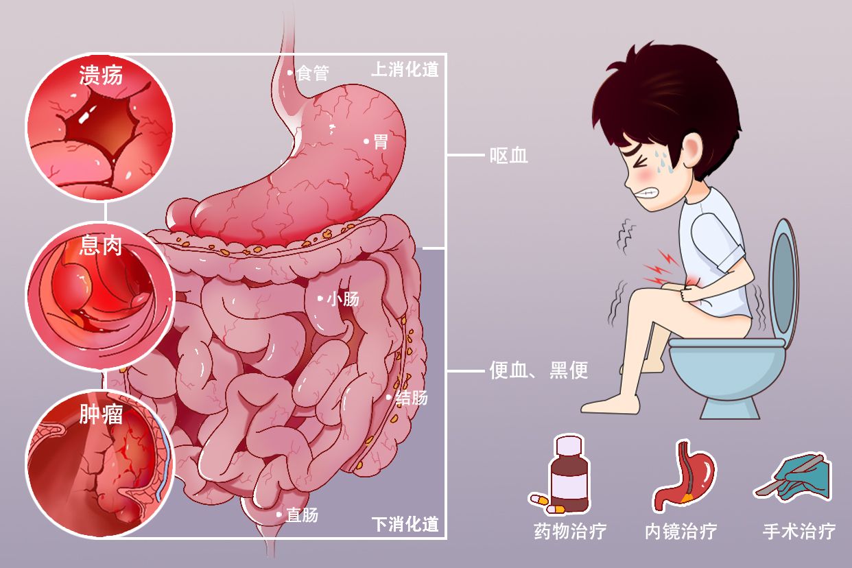 消化道出血卡通图片