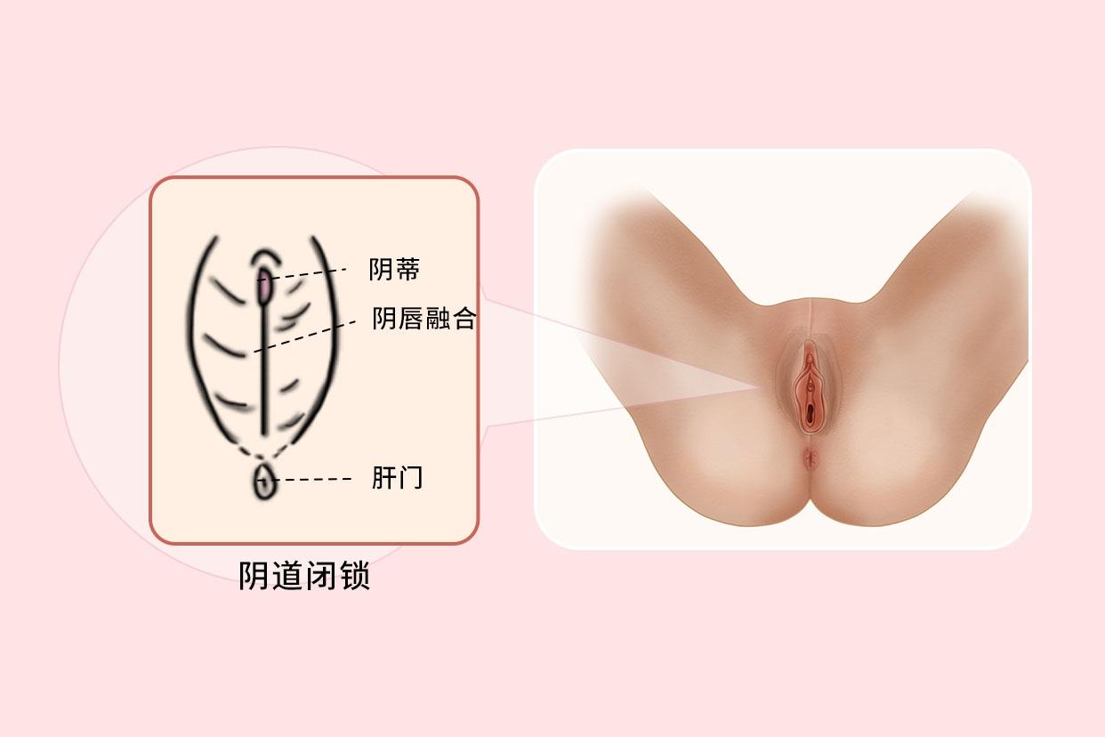 阴道 