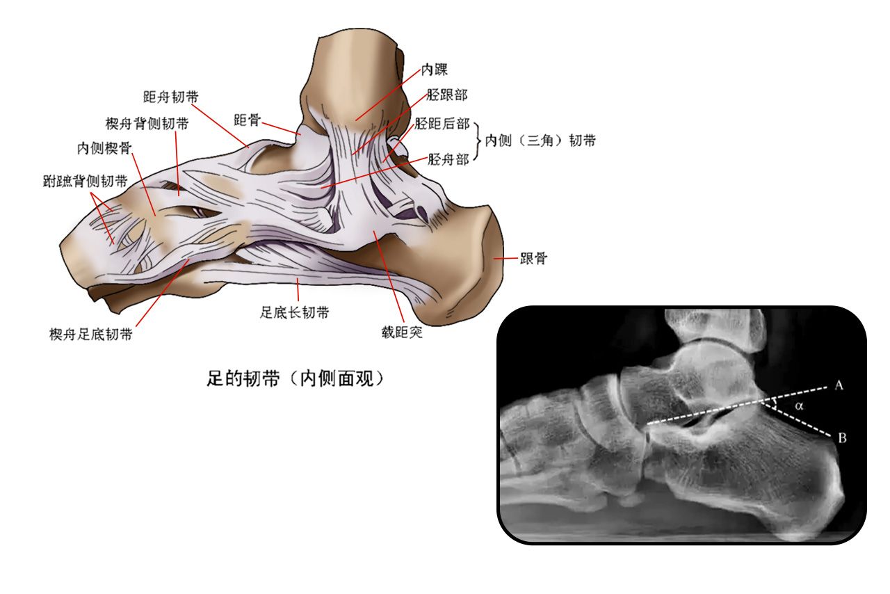 跟骨结节图片