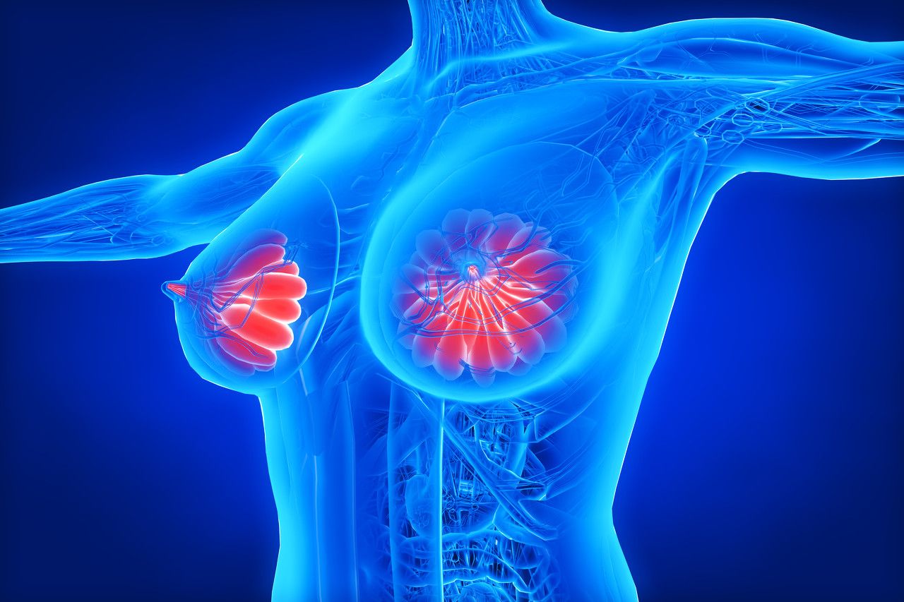 男性乳腺发育——大腺体小胸
