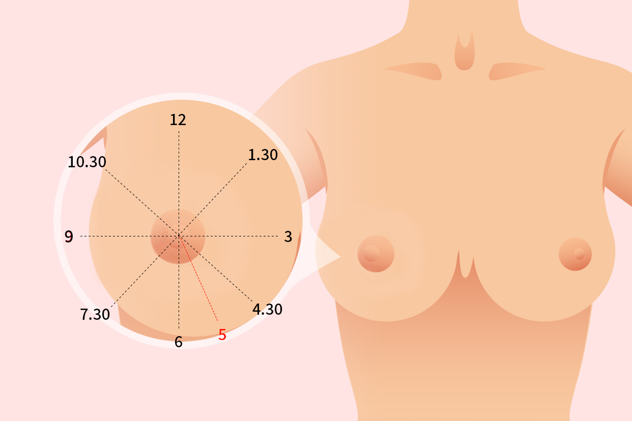 乳腺象限的划分图图片