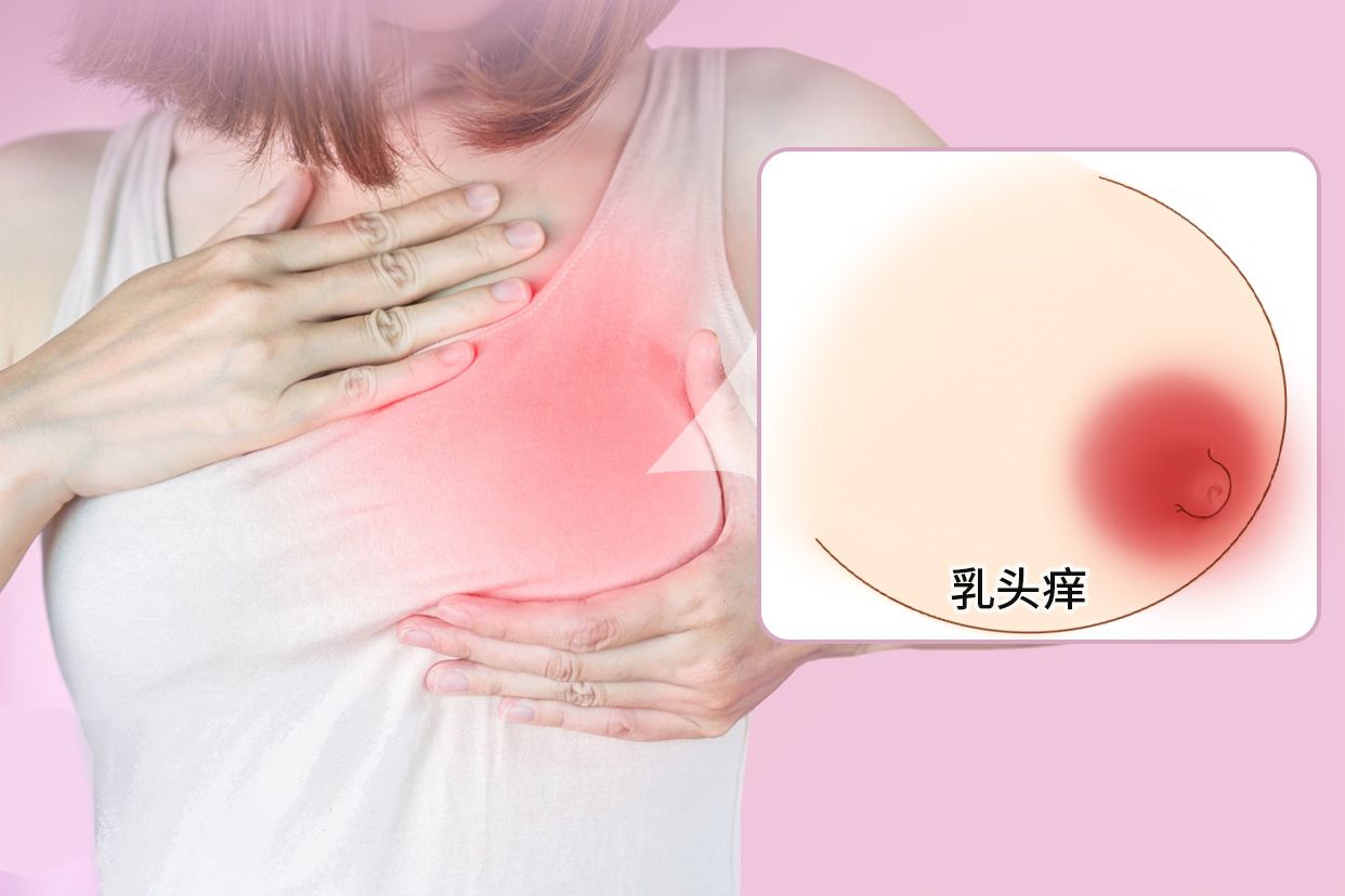 乳头痒是什么原因图片