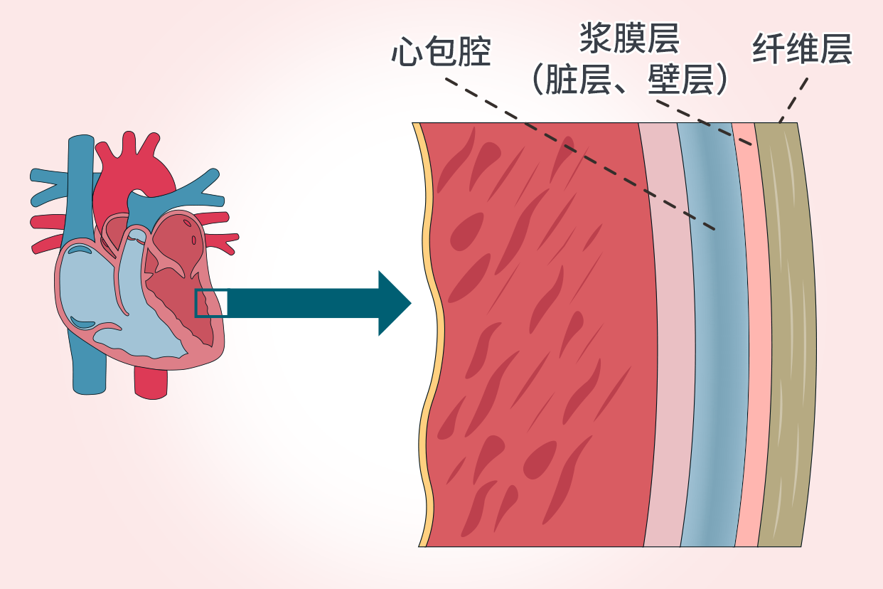 心包脏层和壁层分布图图片