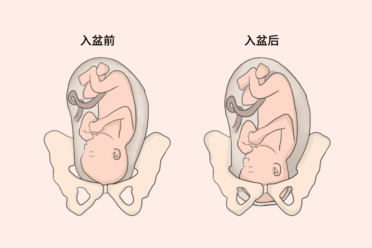 孕肚入盆前后对比图