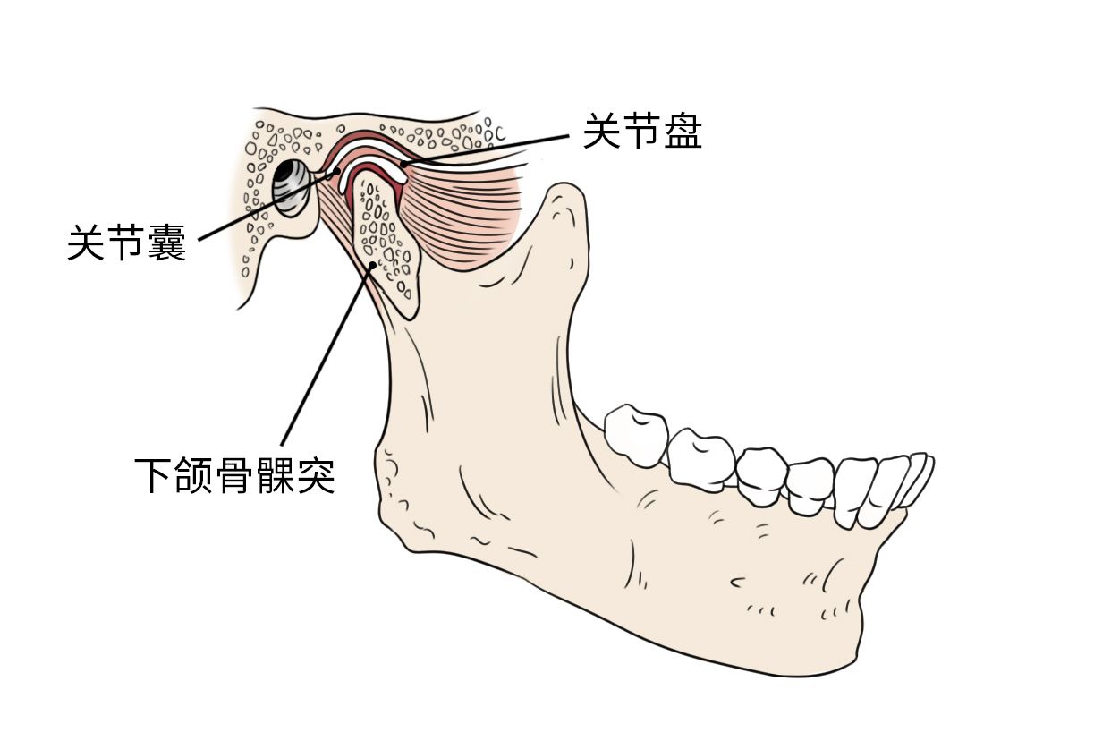 TMD颞下颌关节紊乱的进