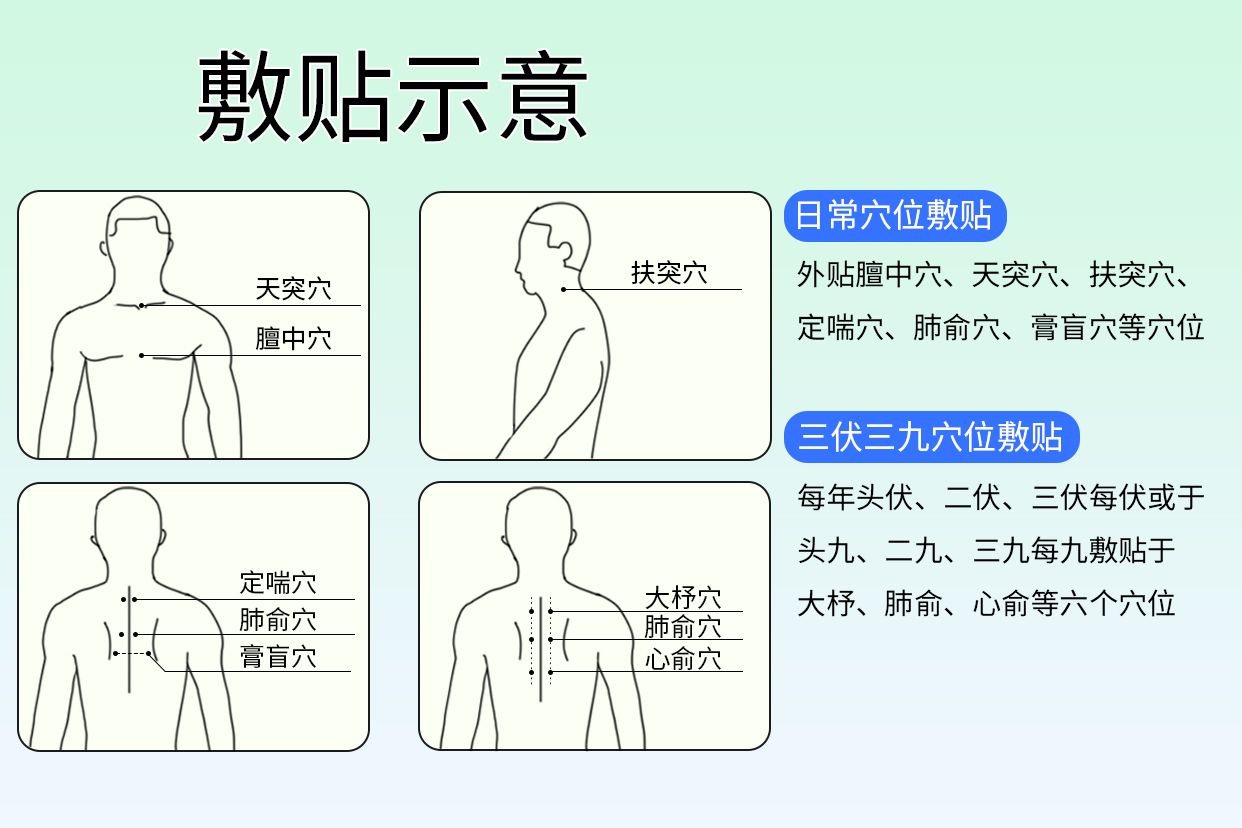 瑞芬坦定磁热贴的功效