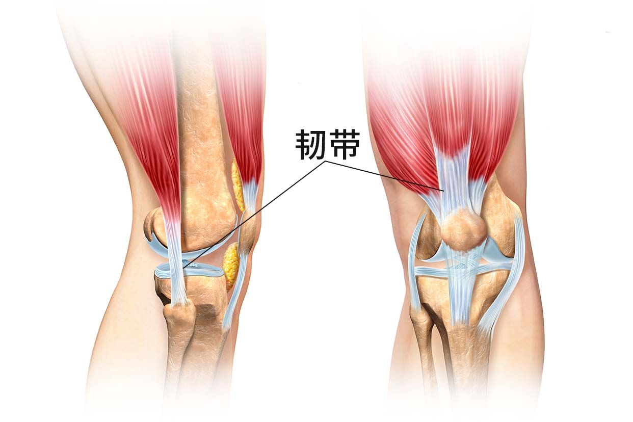 髌骨脱位做了内侧韧带紧缩和外侧韧带松解
