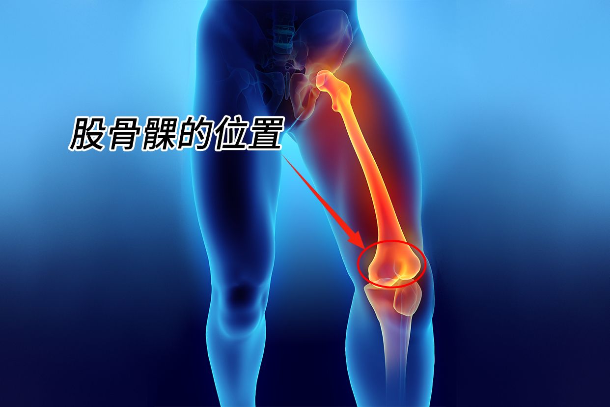 股骨髁上骨折术后多久可以走路锻炼