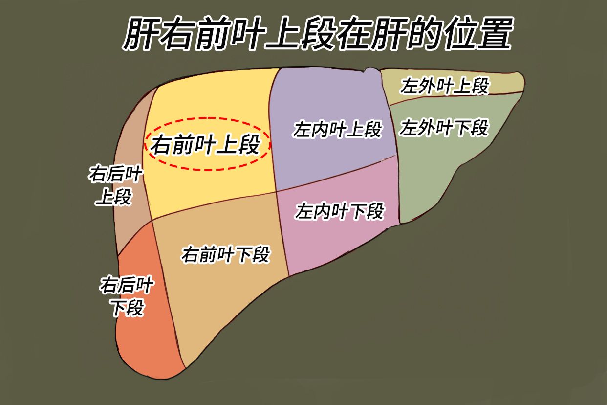 肝s8段位置图图片