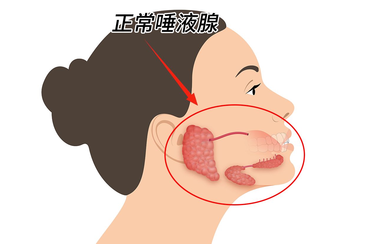 唾液腺受损口干怎么办