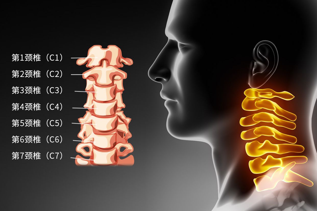 颈椎病常见病因及分型