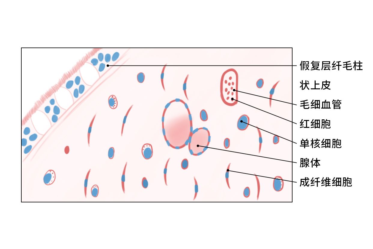 鼻息肉切片图