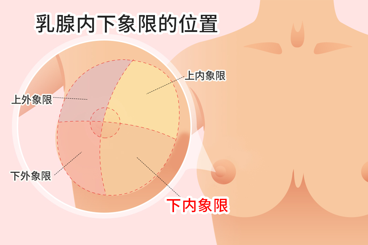 乳腺增生和乳腺结节怎么治?