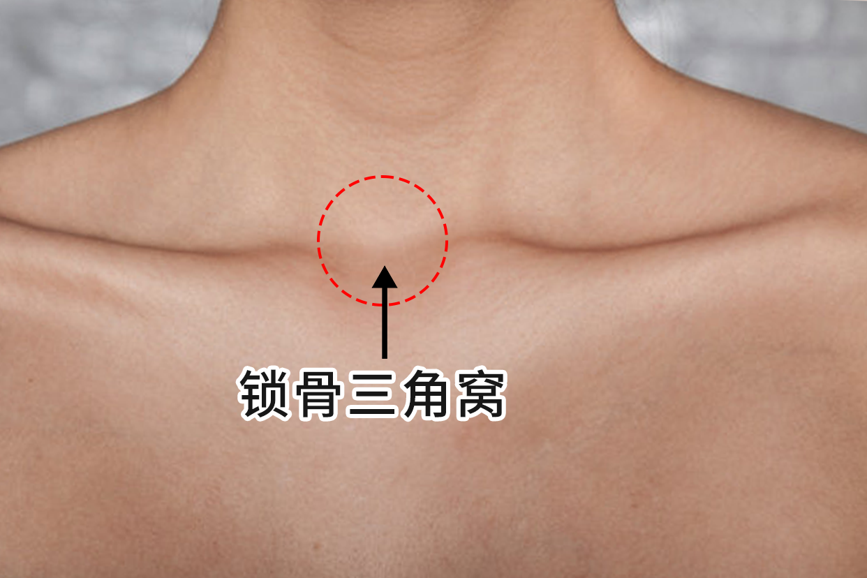 锁骨三角窝有一块软肉怎么回事