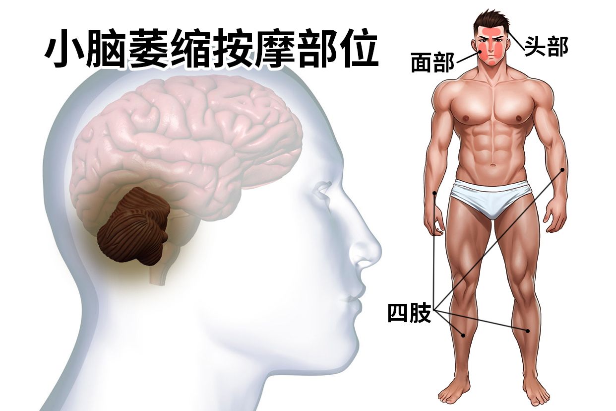 小脑萎缩按摩哪里可以缓解症状