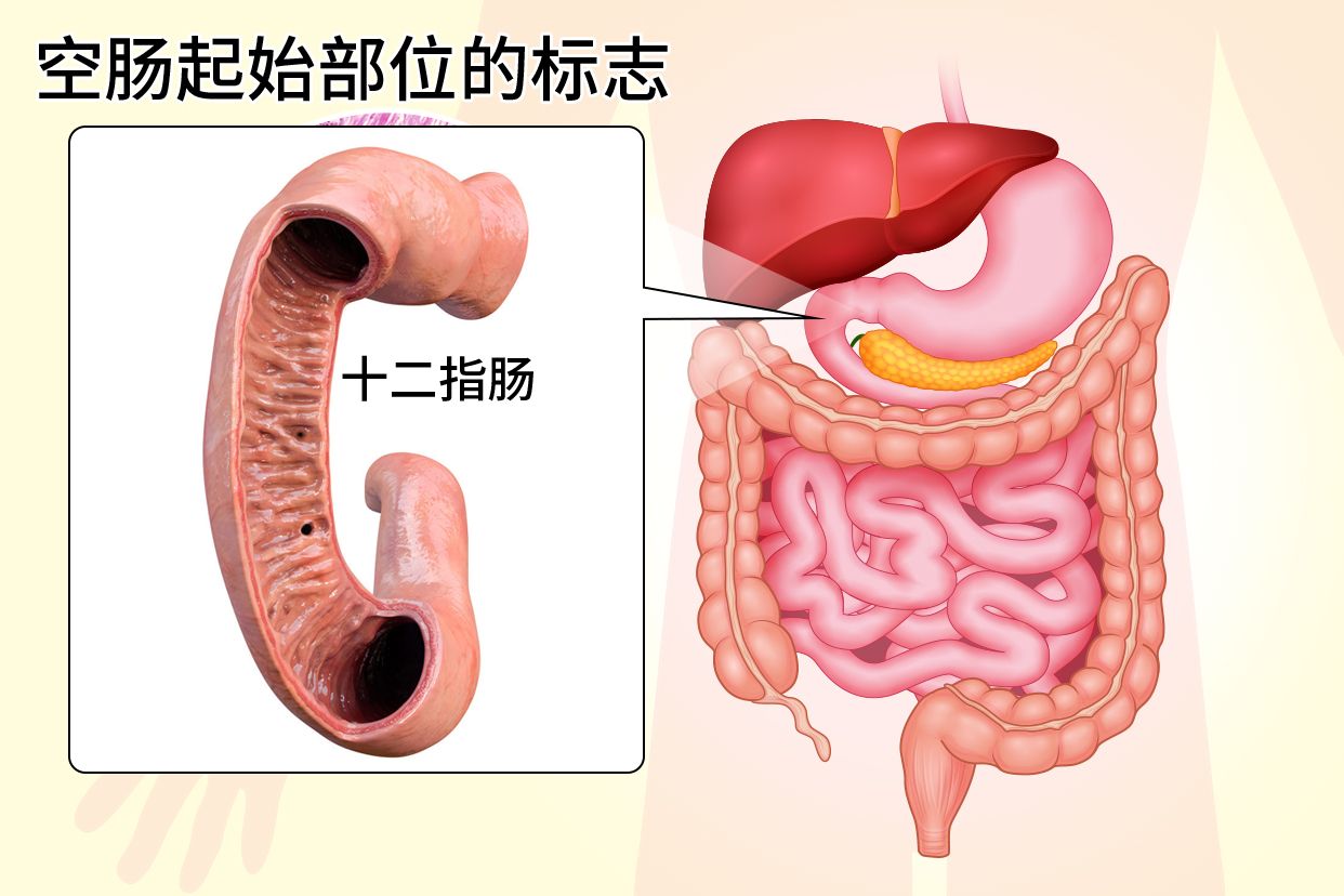 从空肠管打进去的营养液会反流到胃里吗