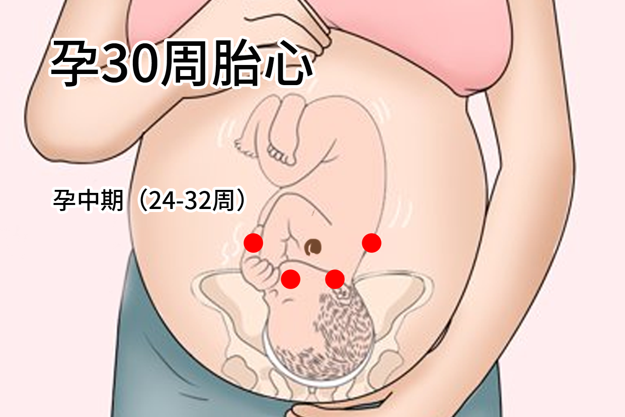 孕30周胎心在哪个位置