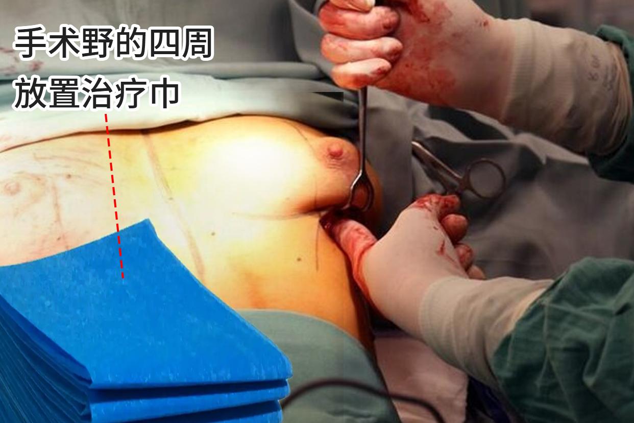 乳腺纤维瘤手术伤口结痂多久能脱落