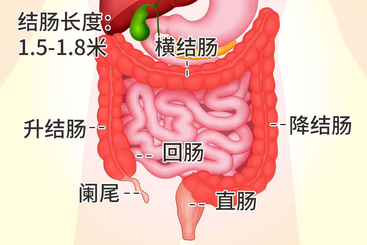 乙状结肠中至低分化腺癌