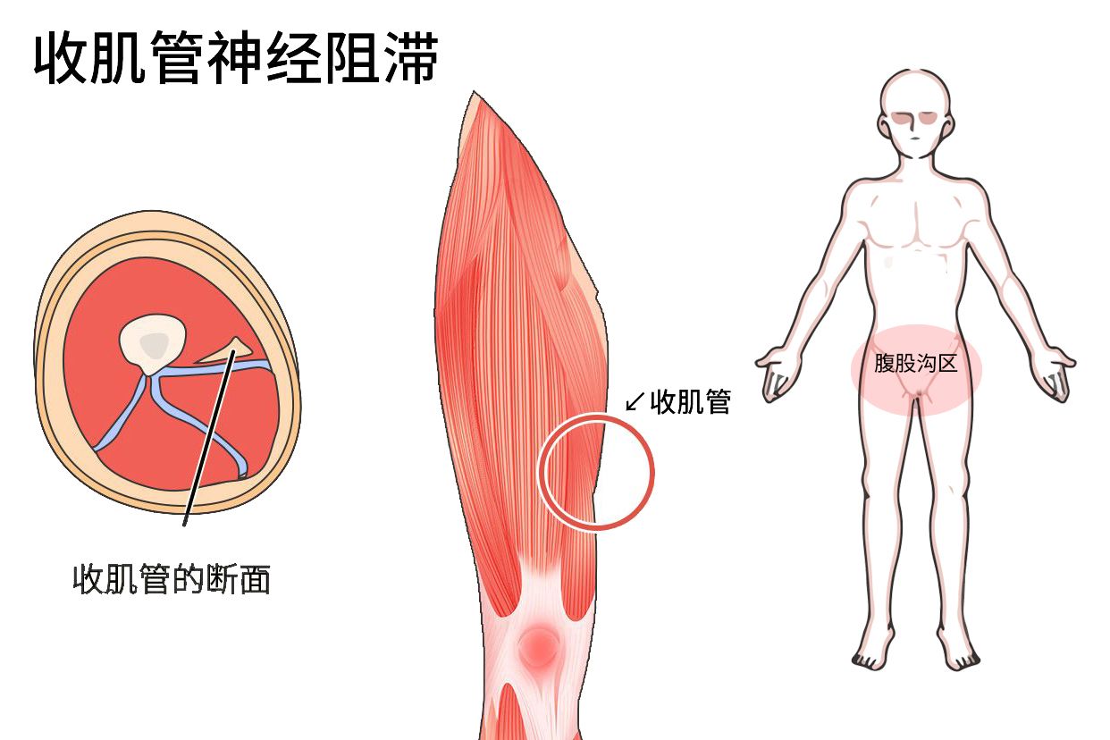 收肌管阻滞和隐神经阻滞的区别