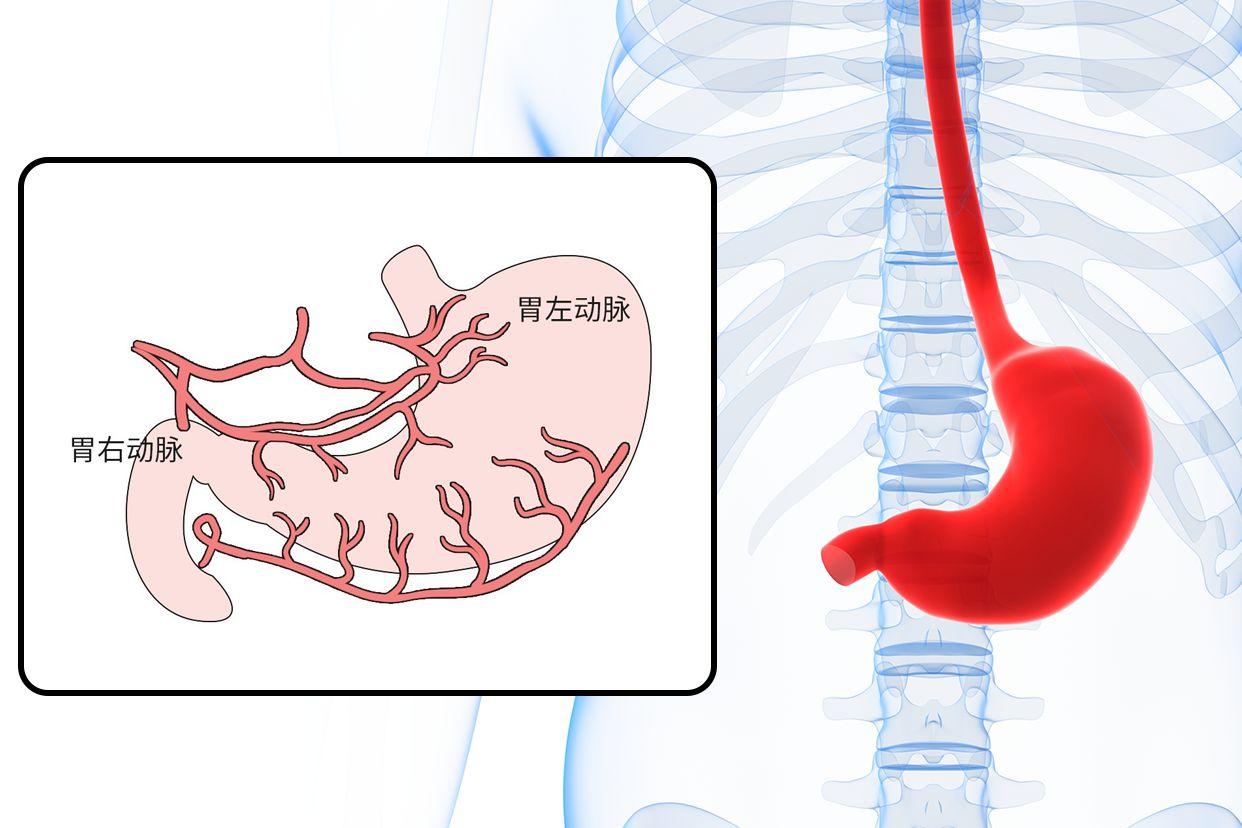 胃部动脉图