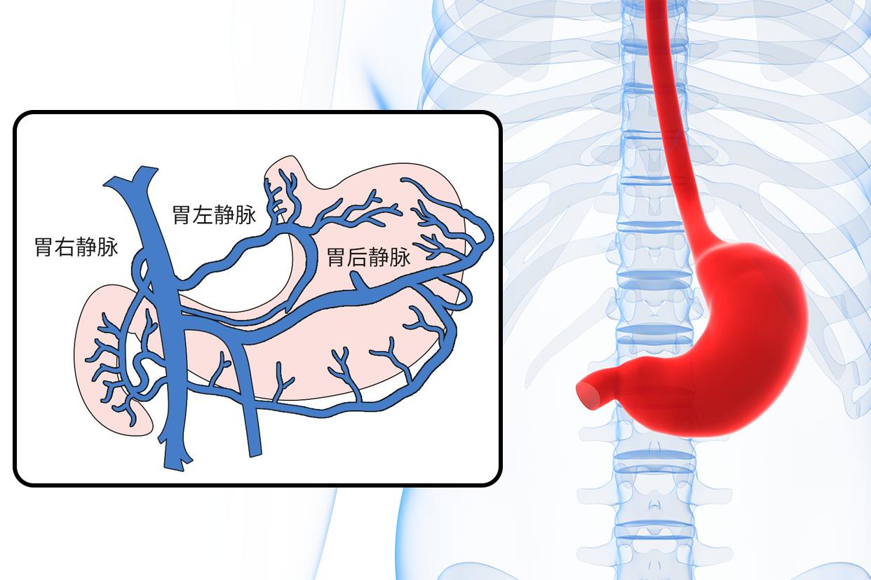 胃部静脉图
