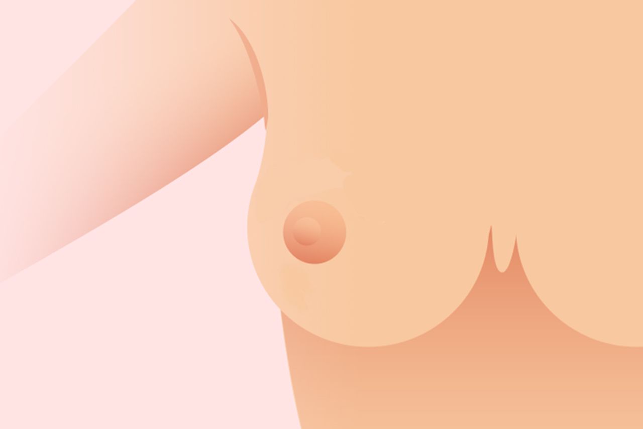 乳头癌手术后能活到正常死亡吗