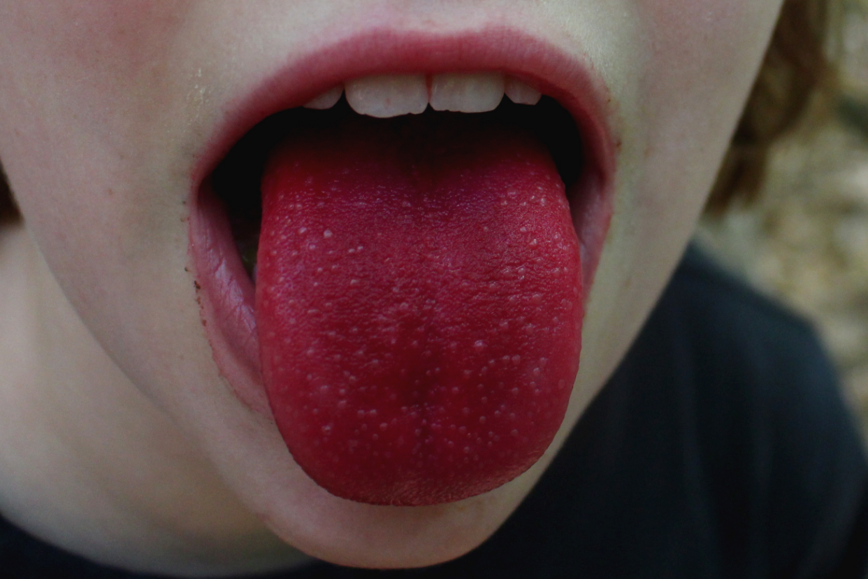 舌头白有红点点怎么回事