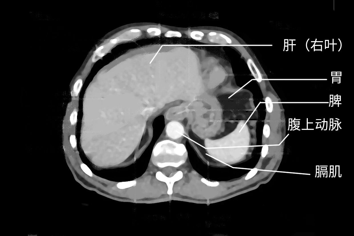 胆道系统ct解剖图图片