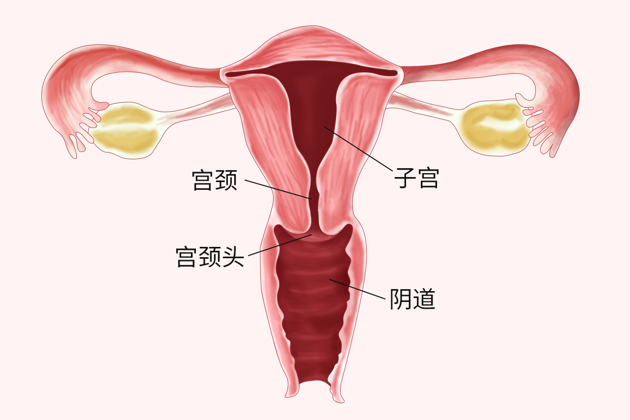 宫颈治疗支架图片图片
