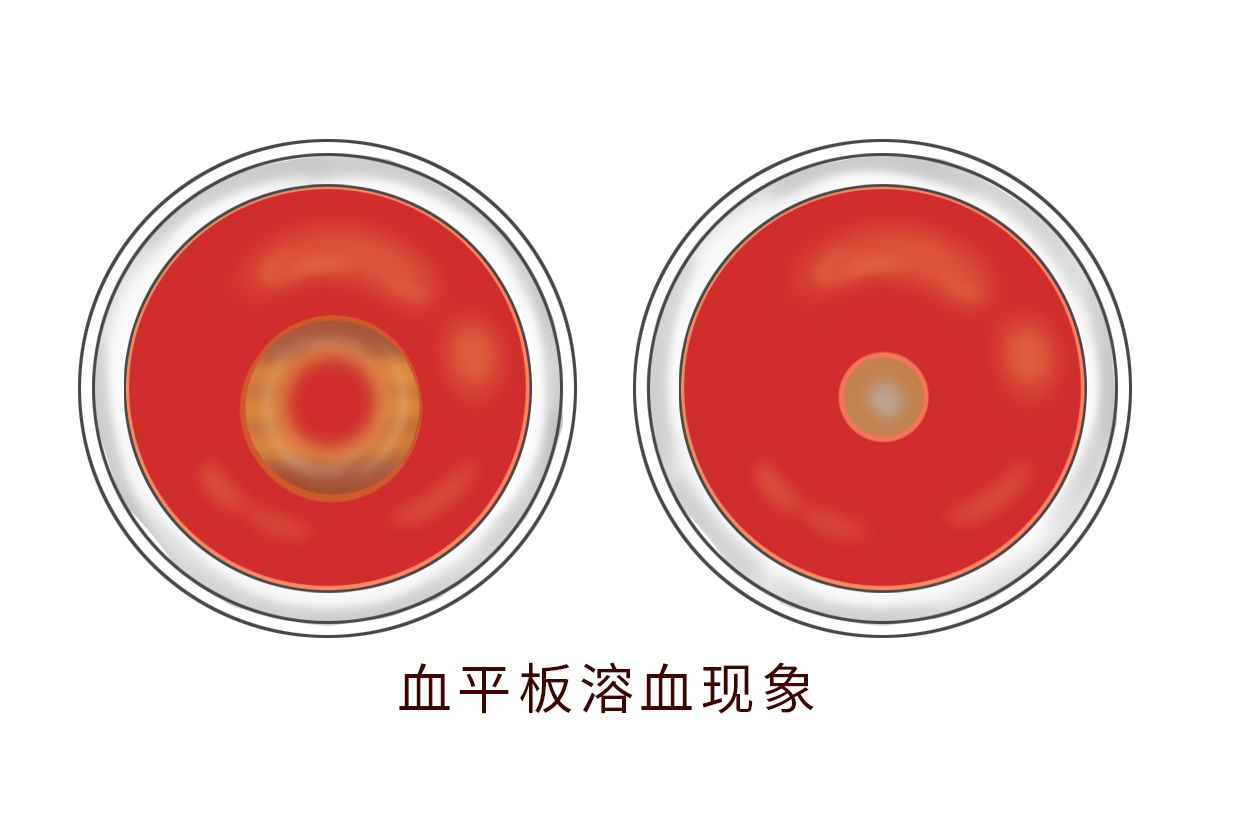 血平板溶血现象图片图片