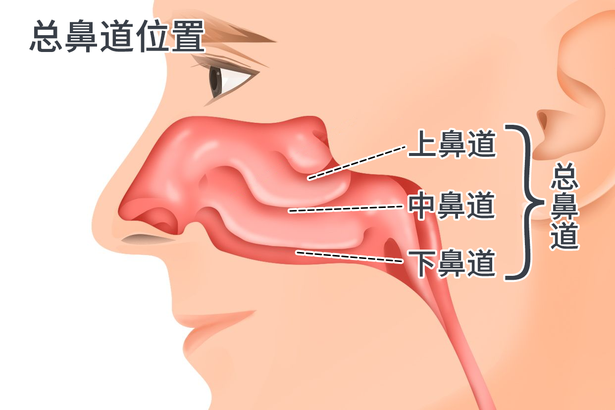 总鼻道图片