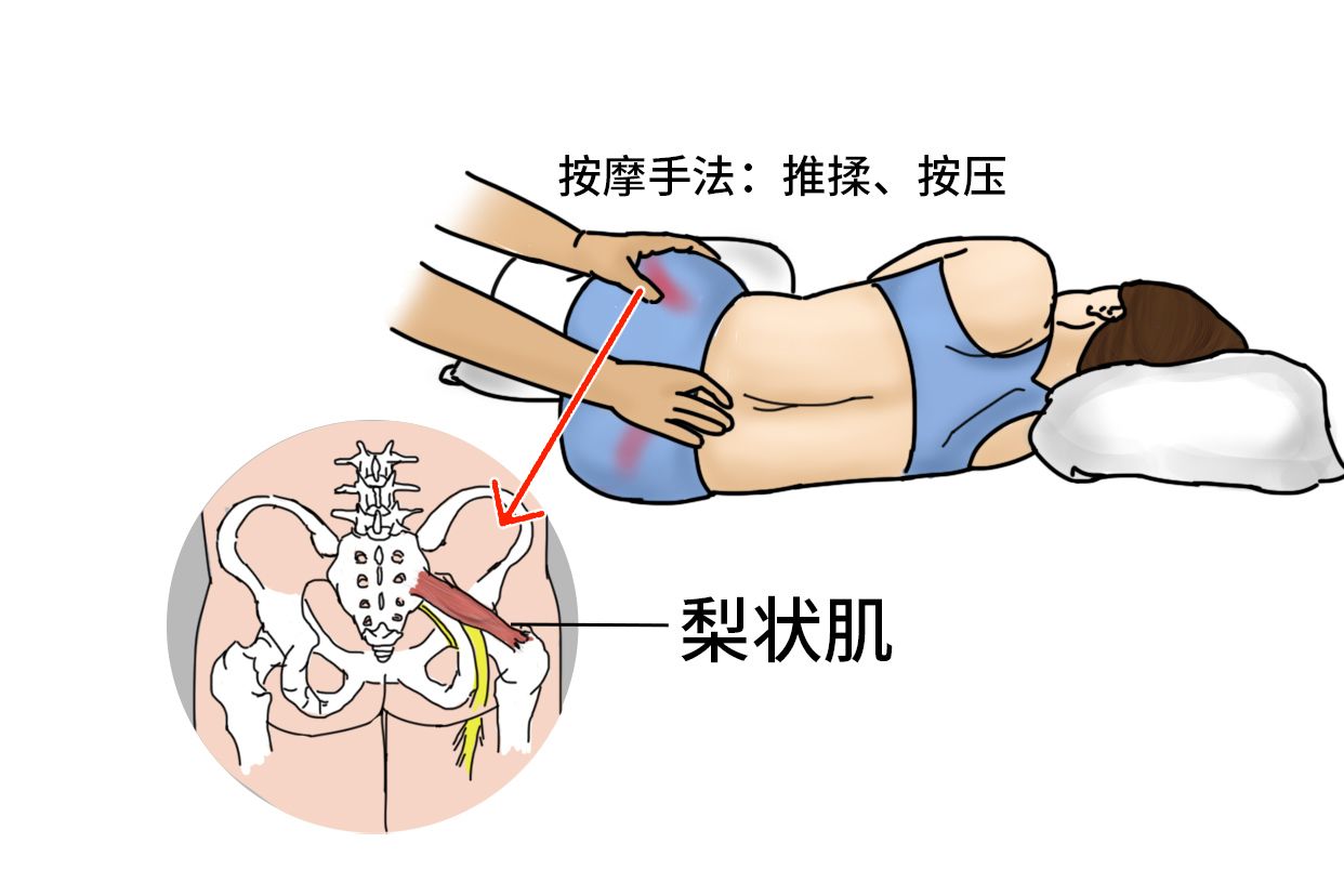 梨状肌位置及按摩图