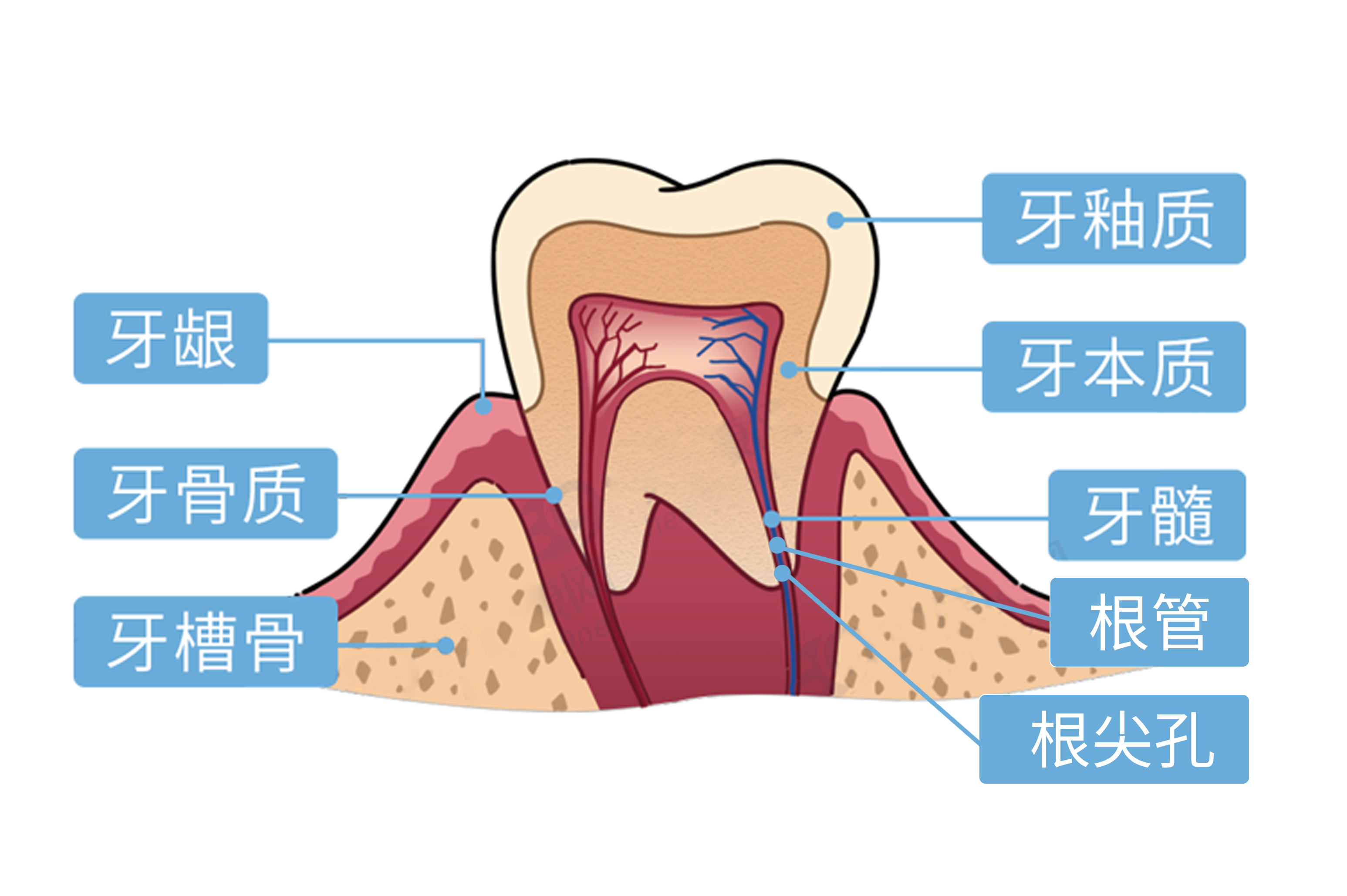 牙槽骨萎缩可以种植牙吗?