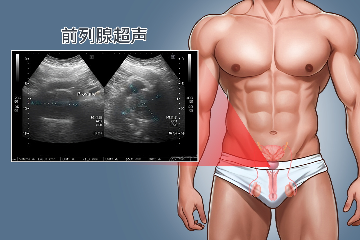 前列腺大小测量示意图
