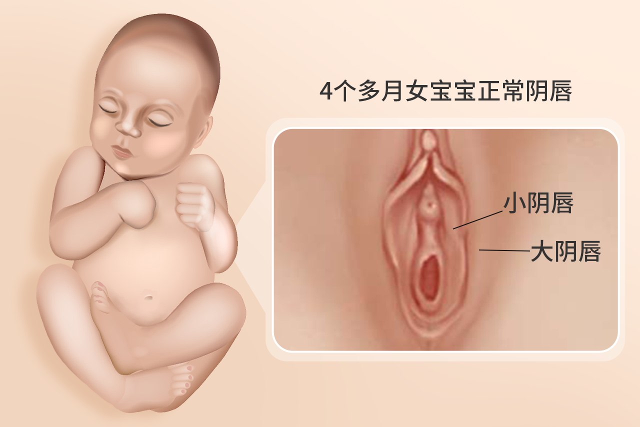 小阴唇 4个多月女宝宝正常阴唇是什么样的图_39健康网