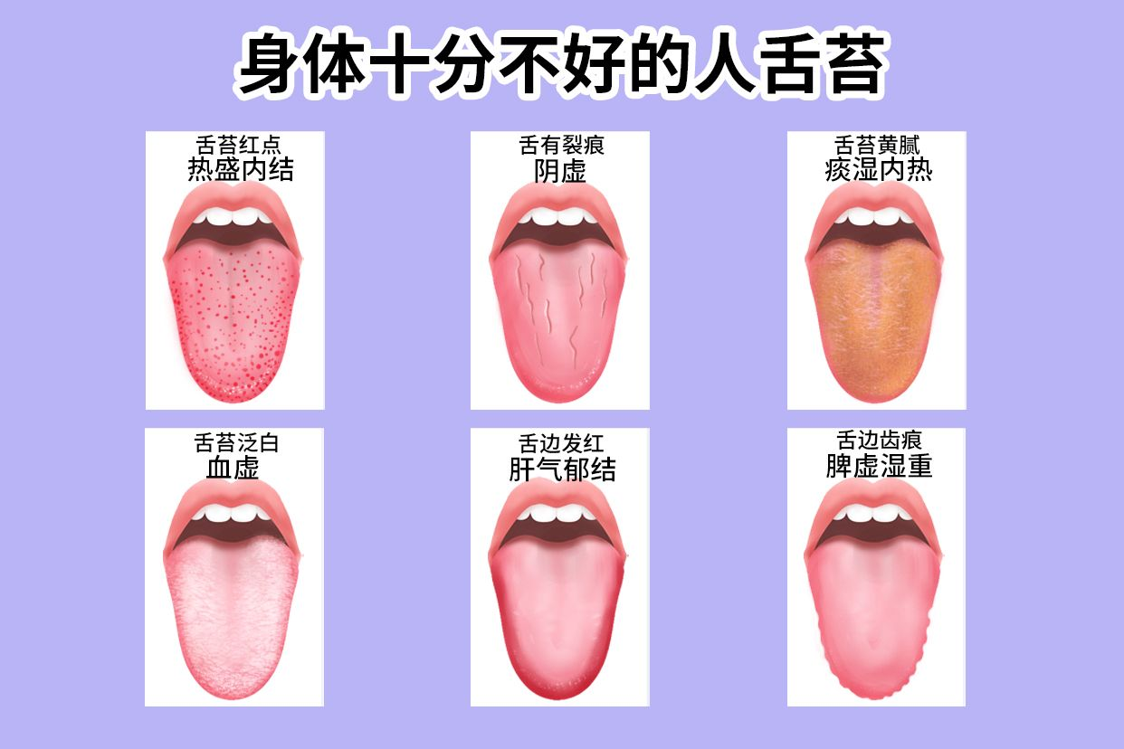 积食和受寒舌苔的区别