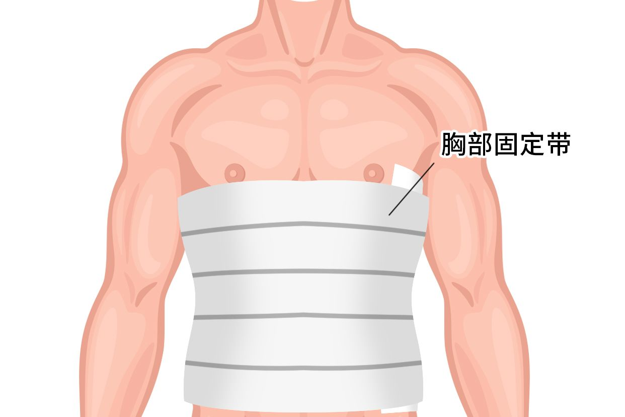 胸骨固定带多长时间可以去掉