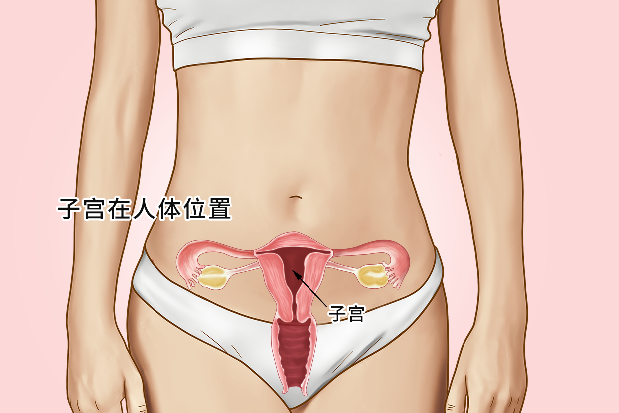 子宫内膜异位症的病因是什么?