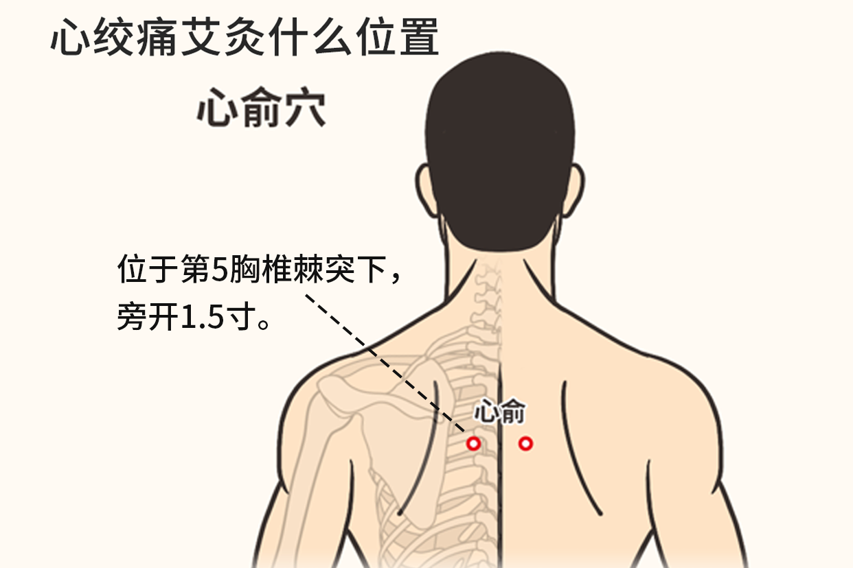 心绞痛艾灸心俞穴位置图